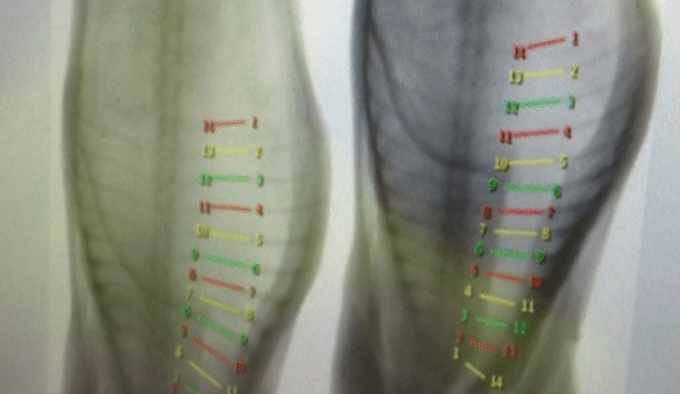 Australia positions to become world leader in objective carcase measurement