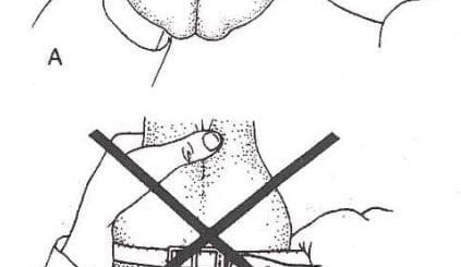Understanding why and how to measure scrotal size