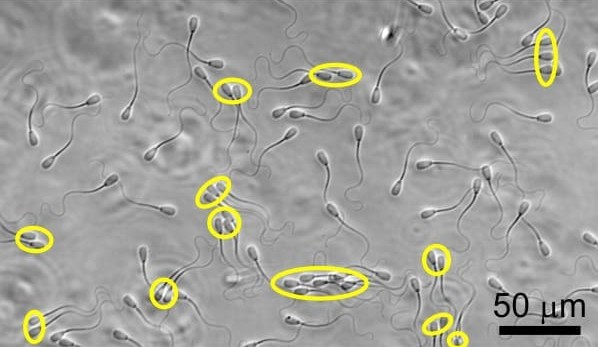 Fertility research: Sperm perform like they are in a bike racing ‘peloton’